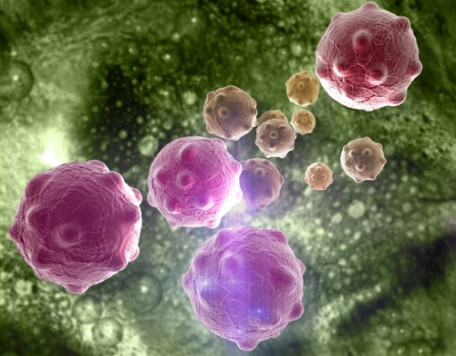 Body 29 Cancer Cells